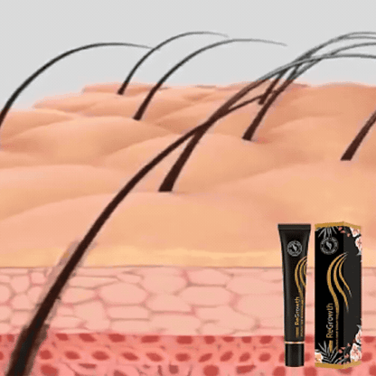 Root Force